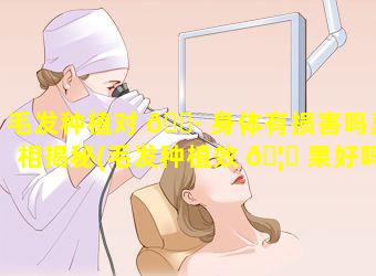 毛发种植对 🌷 身体有损害吗真相揭秘(毛发种植效 🦆 果好吗费用多少)